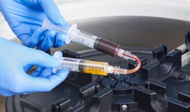 Blutderivate in der biologischen Orthopädie: PRP, APC und ACS im Überblick